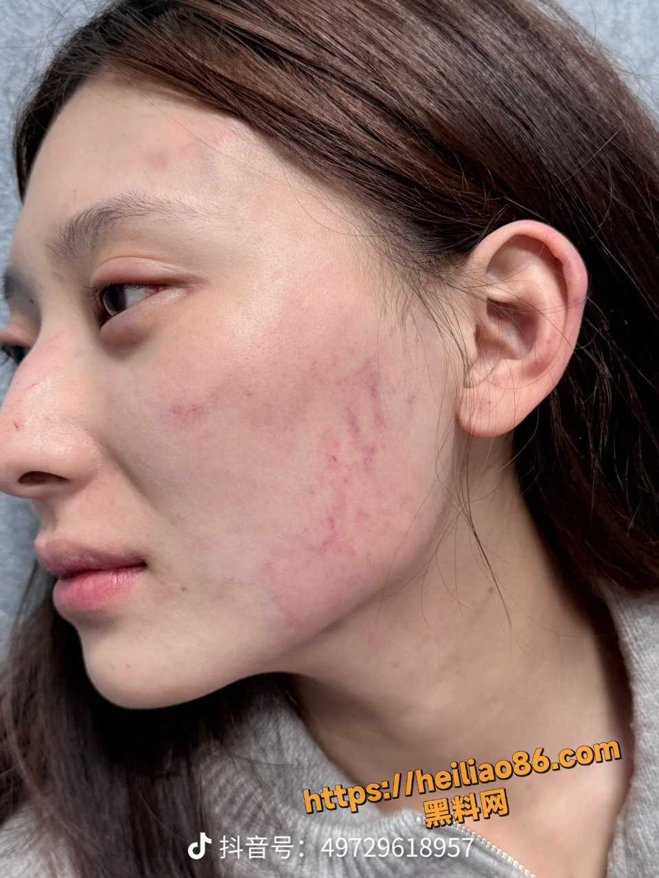 张百乔小雪家暴视频8